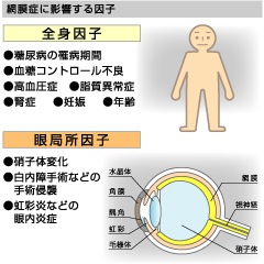 網膜症に影響する因子