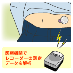 血糖値の日内変動を把握するために