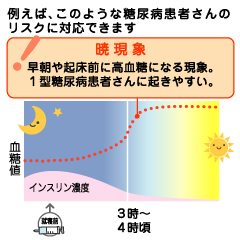 CGMのメリットが特に活かされる患者さん