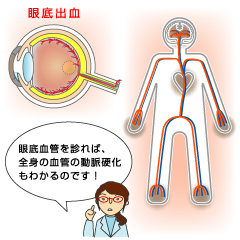 目は唯一、体を切らずに血管の状況がわかる器官