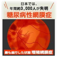 年間3,000人が失明！ 糖尿病網膜症
