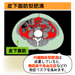 高度の肥満で、生活習慣病は悪化する