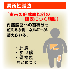 人間ドックで指摘された「異所性脂肪」