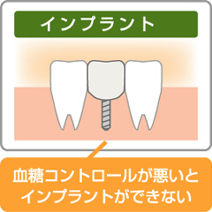 糖尿病だと、高度歯科治療ができないこともある