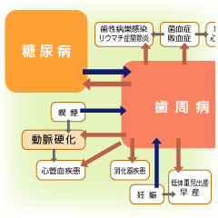 歯周病だと糖尿病に、糖尿病だと歯周病になる！
