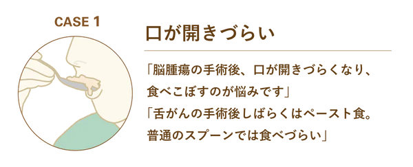 CASE 1: 口が開きづらい